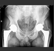Orthopaedic & Joint Replacement Service
